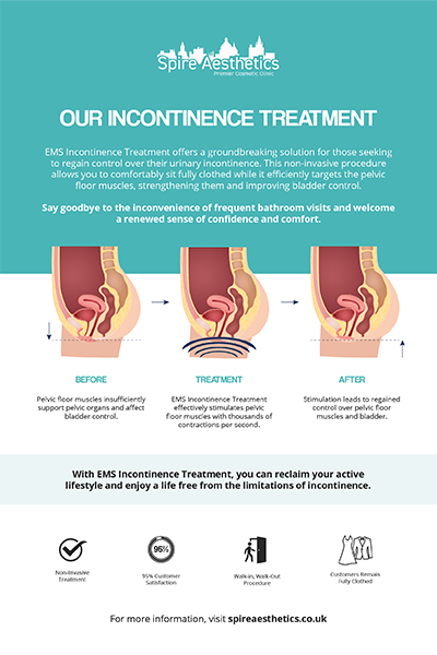 image of how urge incontinence Kirkby in Ashfield treatment works