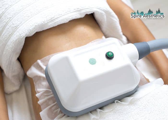 Shift Those Extra Pounds: How Fat Freezing Can Help You Slim Down Kirkby in Ashfield