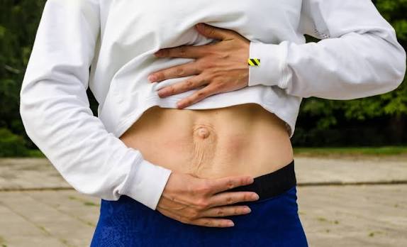 When Could Diastasis Recti Be the Missing Piece of the Puzzle Kirkby in Ashfield?